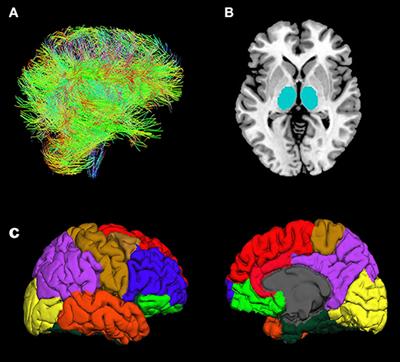 White Matter Connectivity and Gray Matter Volume Changes Following Donepezil Treatment in Patients With Mild Cognitive Impairment: A Preliminary Study Using Probabilistic Tractography